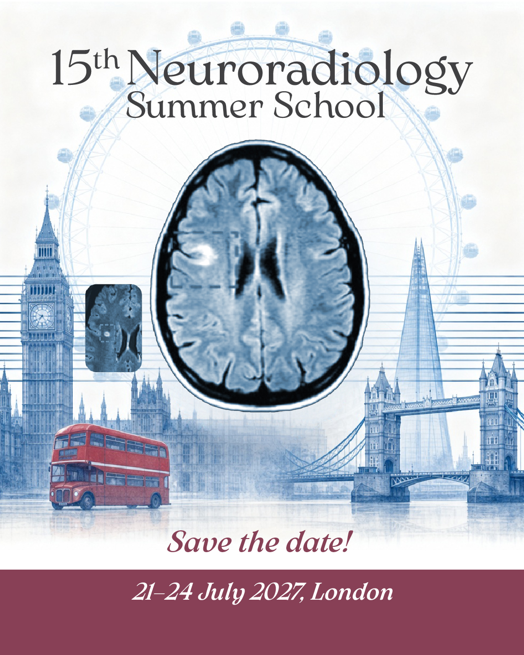 15th Neuroradiology Summer School – Save the date, 21–24 July 2027, London