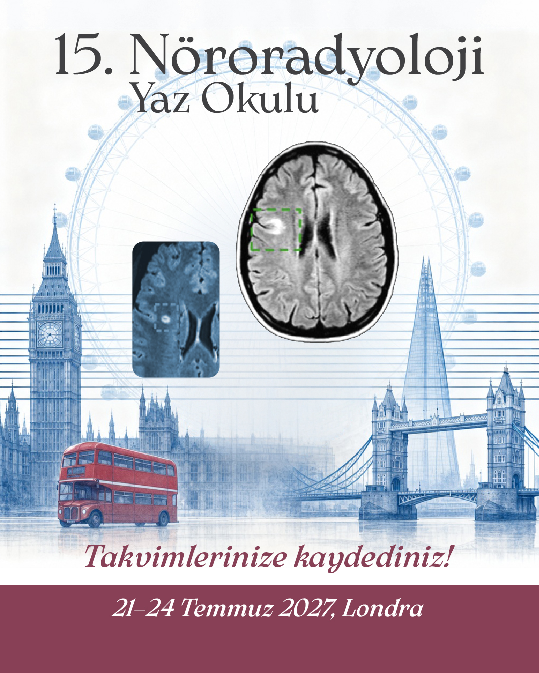 15. Nöroradyoloji Yaz Okulu – Takvimlerinize kaydediniz, 21–24 Temmuz 2027, Londra